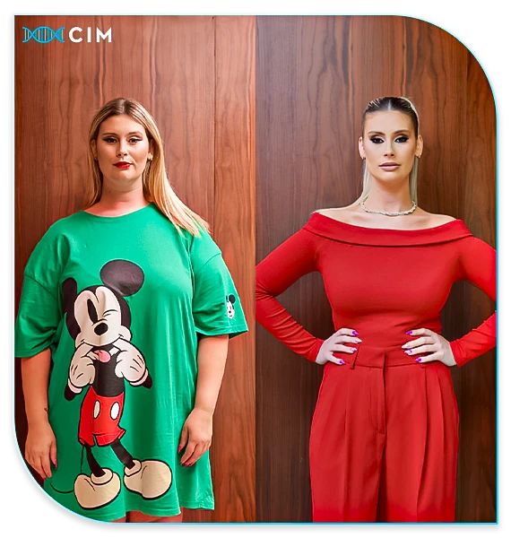 Perceba como o Sleeve Gástrico pode ajudá-lo a emagrecer de forma segura e duradoura